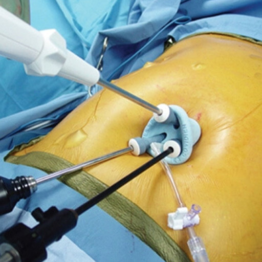 Single Port Bariatric Surgery