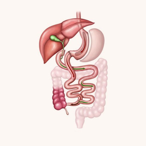 Duodenal Switch Surgery in Ahmedabad