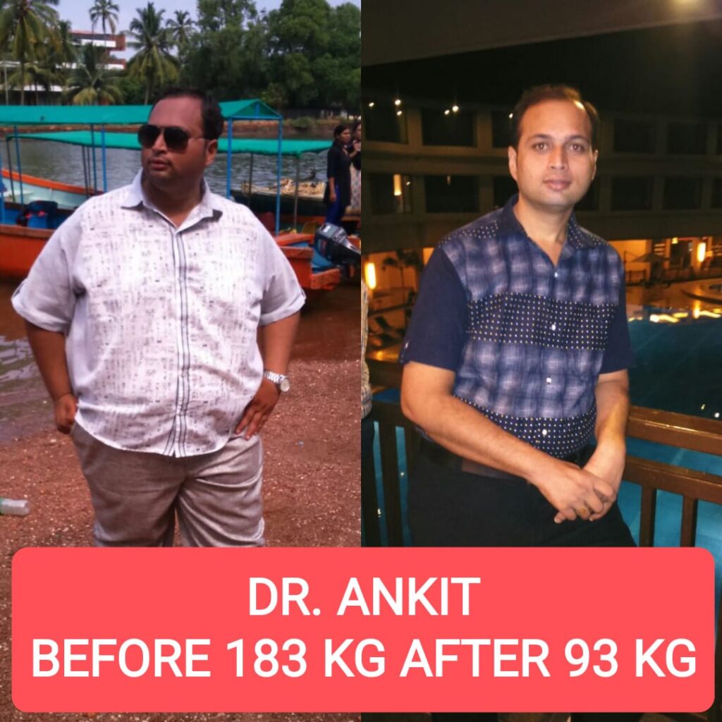 Before and After Dr. Ankit