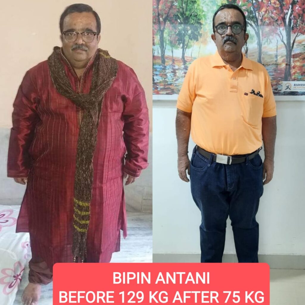 Before and After Mr. Bipin Antani
