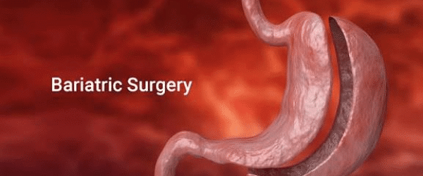 The Ultimate 2026 Guide to Weight Loss in Ahmedabad: Bariatric Surgery vs. Injections, Costs, and Insurance